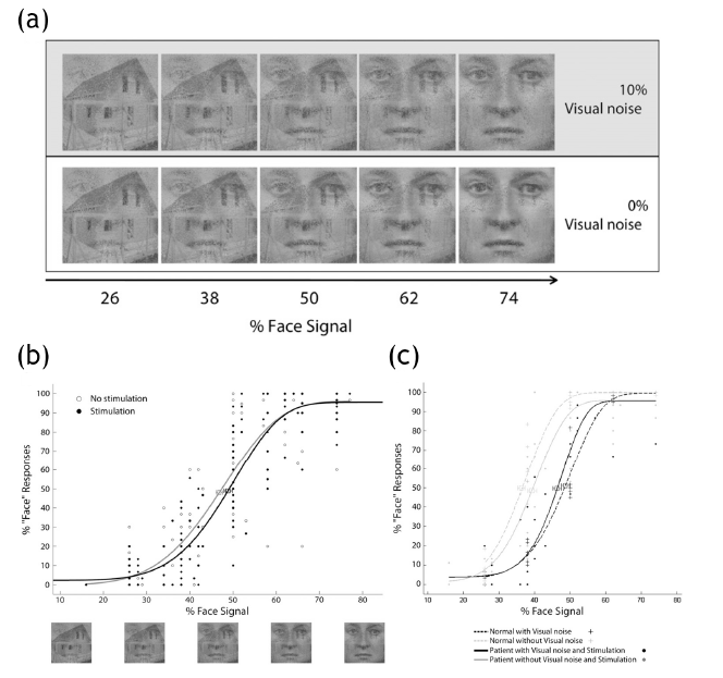 (a) 전기 자극 실험에 사용된 자극. 시각적 잡음이 10% 있는 경 우(위쪽)와 시각적 잡음이 없는 경우(아래쪽). (b) 시각적 잡음이 없는 경우 환자군의 전기자극 실험 결과. (c) 시각적 잡음이 있는 경우 정상군의 실험 결과와 환자군의 전기자극 실험 결과.