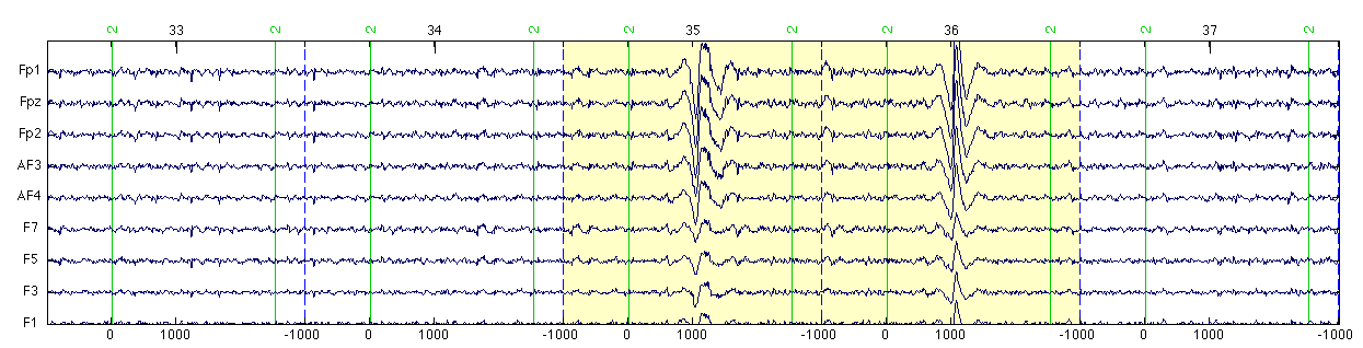독립요소분석 하기 전 눈 움직임 잡음이 포함된 EEG 신호
