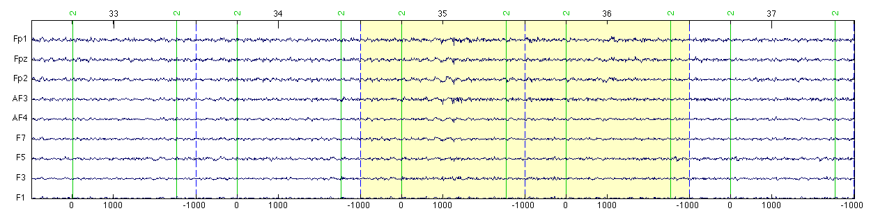 독립요소분석을 통해 잡음이 제거된 EEG 신호