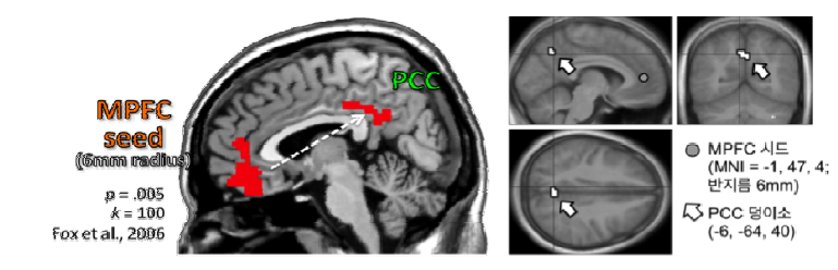 MPFC로부터 PCC로 향하는 DMN 기능적 연결성에 반영된 개인주의-집단주의 자기 해석 스타일 효과.