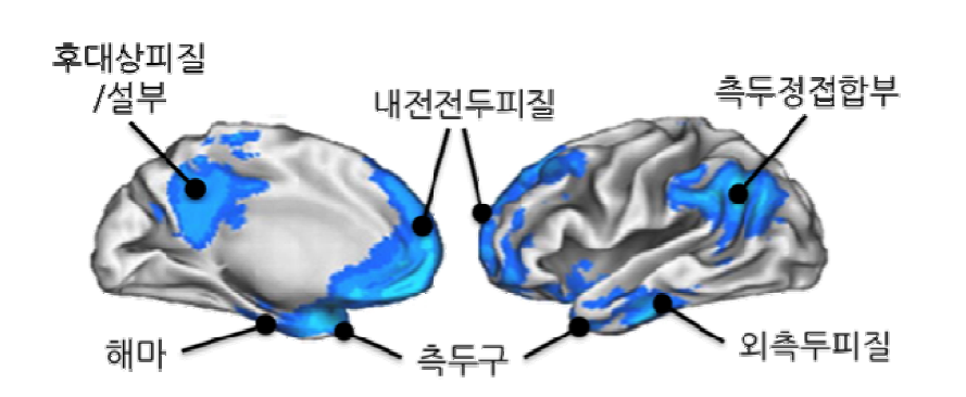 디폴트 모드 연결망.