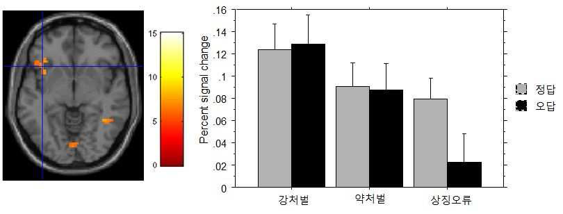 상징오류피드백에 비해 처벌피드백에 더 높게 활성화 한 왼쪽 anterior insula (n=31, up < .005).