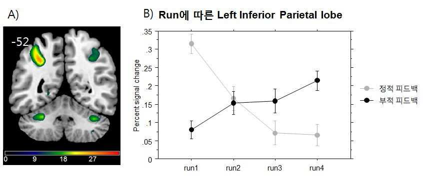 A) run(run1~4)과 피드백 조건(정적피드백/부적피드백)의 상호작용효과를 보이는 두뇌 영역. B) run에 따른 Left Inferior Parietal lobe의 활성화 패턴