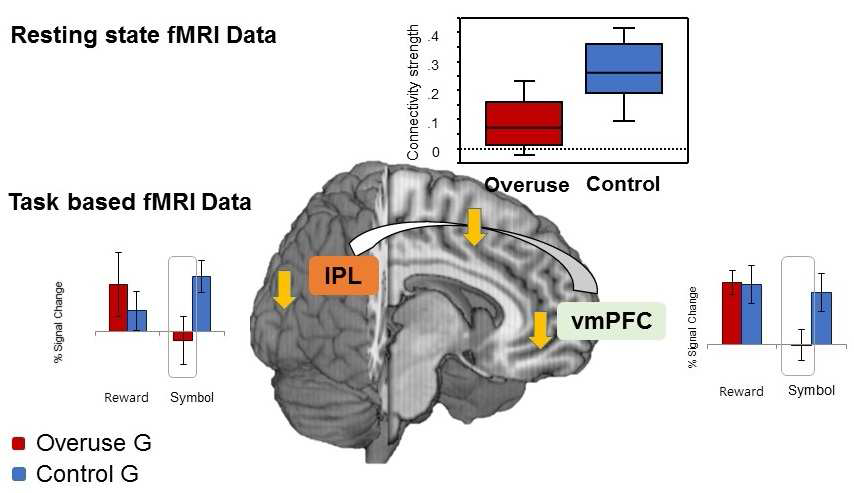 Task based fMRI와 resting state fMRI기법을 이용한 인터넷-게 임 과사용 집단(Internet game overuse 집단)과 관련된 주의 및 보상 두 뇌 회로 특성