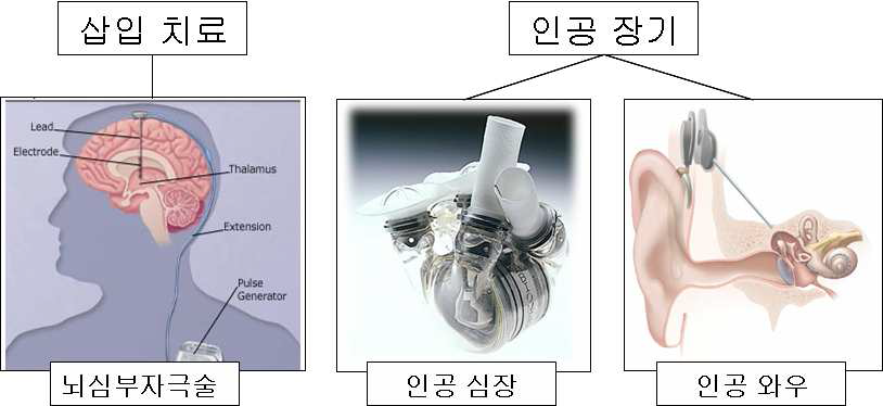 무선 전력 공급 기술의 의학분야 응용