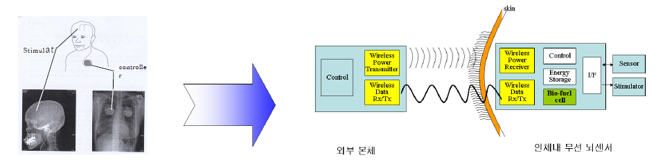 무선 뇌센서의 전력 공급 및 데이터 통신 개념도