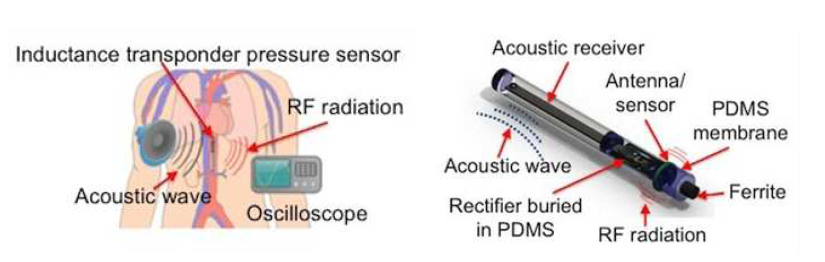 Wirelessly Measure Roll Nip Pressure