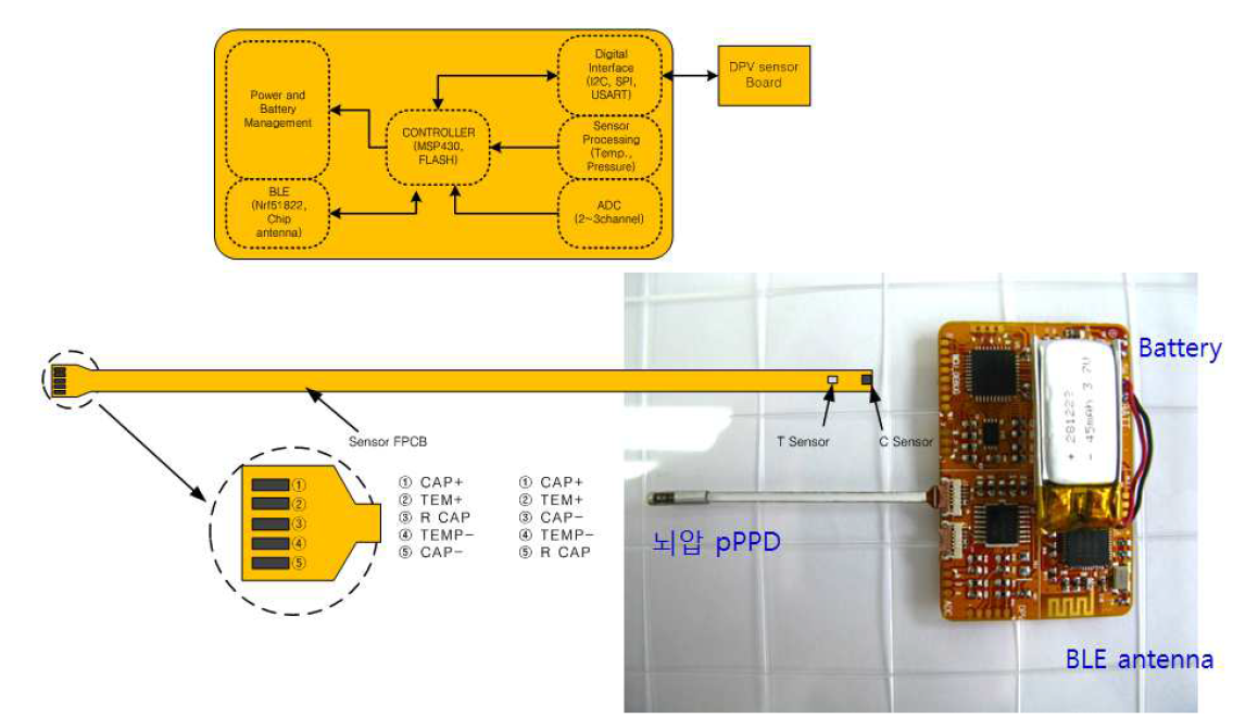 뇌압 PPD와 연결된 WPDT 모듈