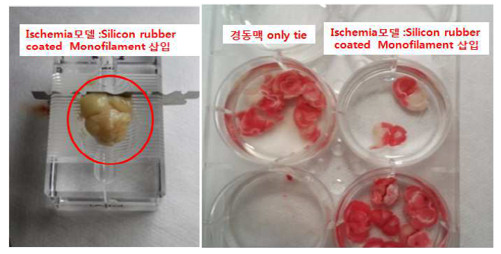 Ischemia 모델 후 쥐 뇌에 부종 발생확인