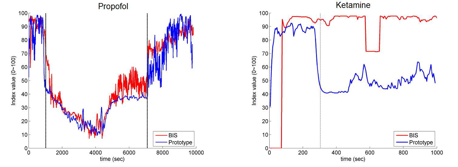 인덱스 장 알고리즘(파랑)을 이용하여 작용 기작이 다른 두 마취제인 프로포폴과 케타민에 대해서 상용 장비인 BIS(빨강)와 비교함
