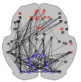 Stam et al. Neuroimage 2002