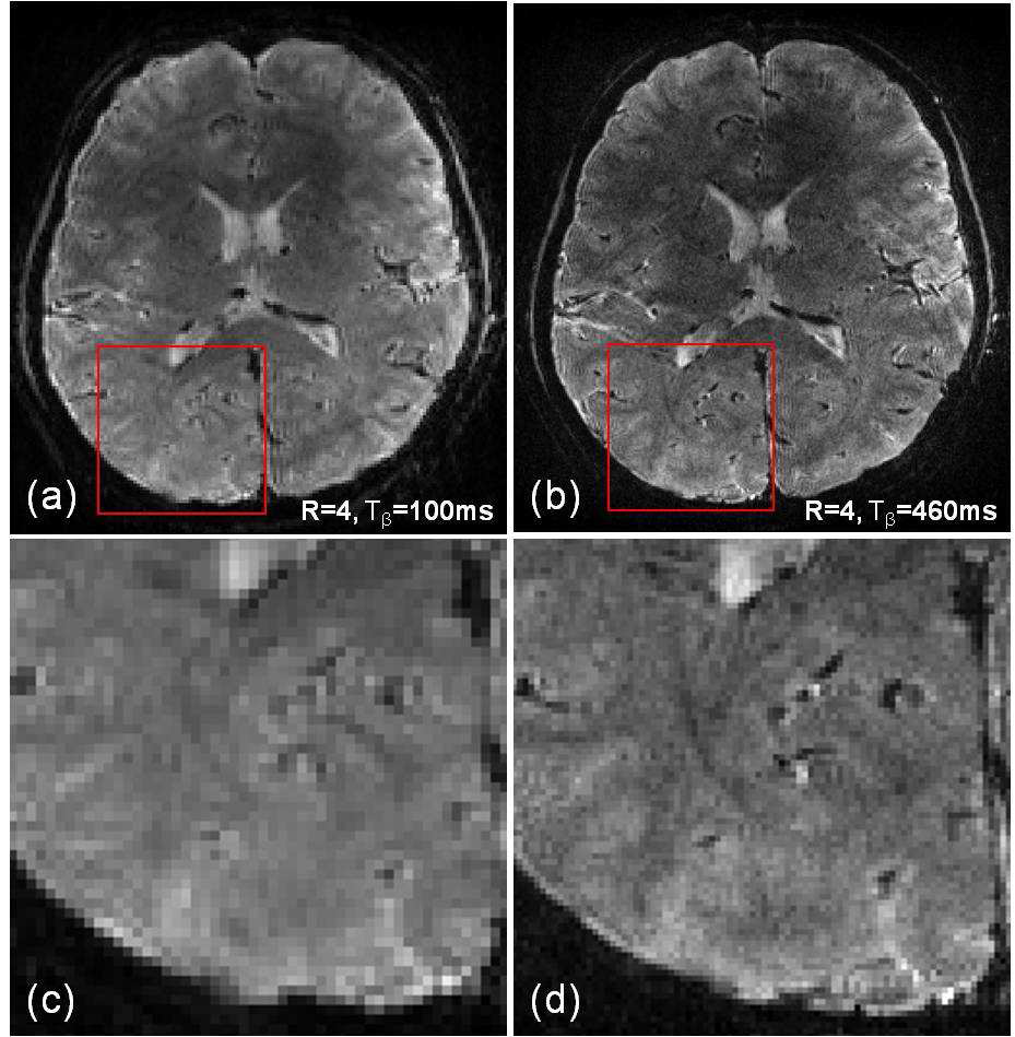 High esolution imaging using ciEPI schemes, in which images have (a) 1.0 mm and (b) 0.6 mm in-plane resolution.