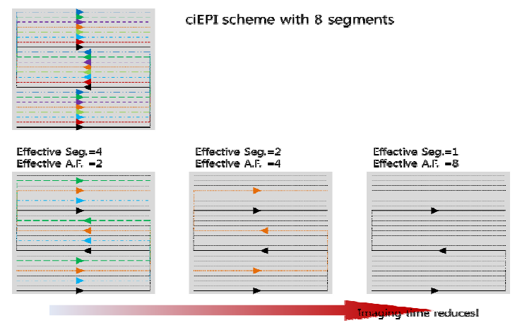 평행 영상 기법을 이용한 ciEPI 구성