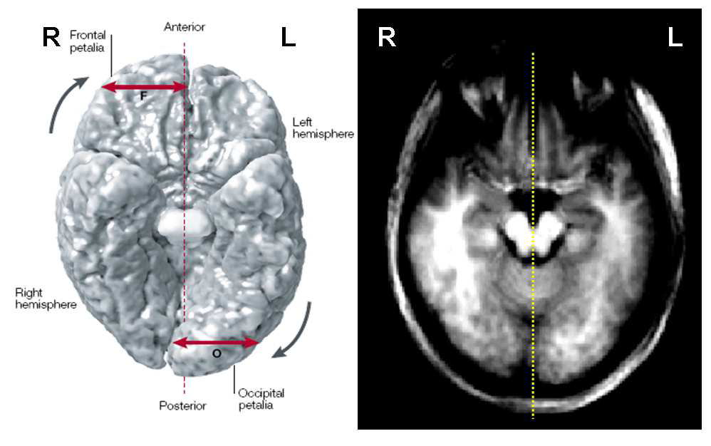 뇌의 비대칭성을 묘사한 그림