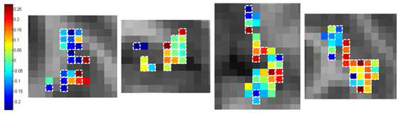 7.0T에서의 Voxel Distribution을 나타내는 맵.