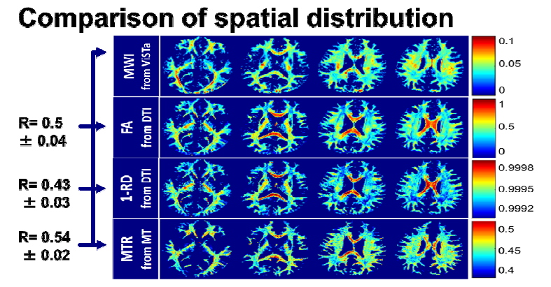 ViSTa Myelin Imaging과 기존 Myelin Imaging 방법들 (DTI, Magnetization Transfer)의 비교연구결과