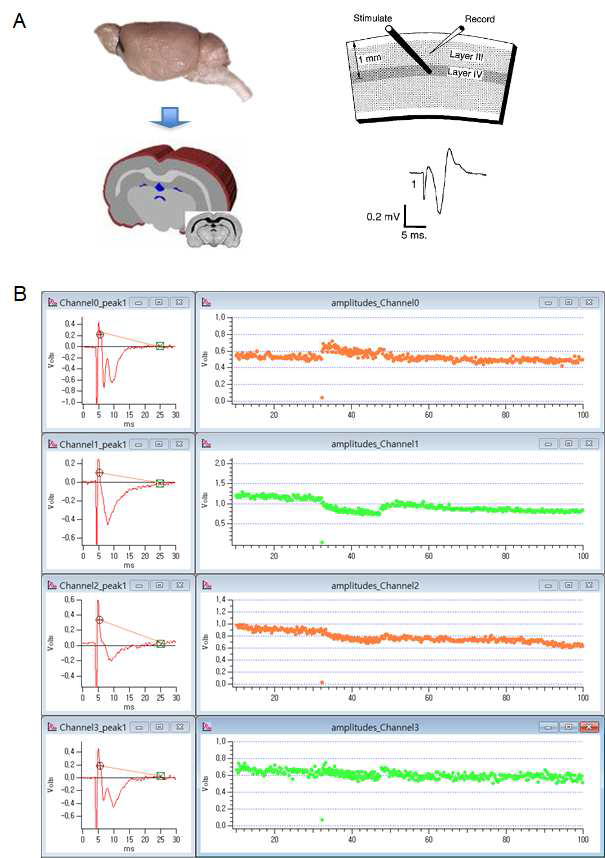 대뇌시각피질과 대뇌측두피질 뇌절편 제작 및 다채널 신경반응 측정