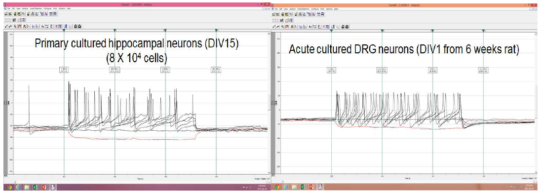 1차 배양 해마신경세포와 체성감각 DRG neuron의 excitability 비교