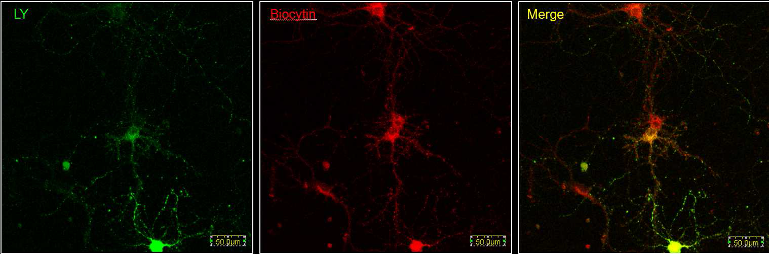 배양된 해마 신경세포를 이용한 신경망의 형태적 분석을 위한 선별적 세포 표지법.