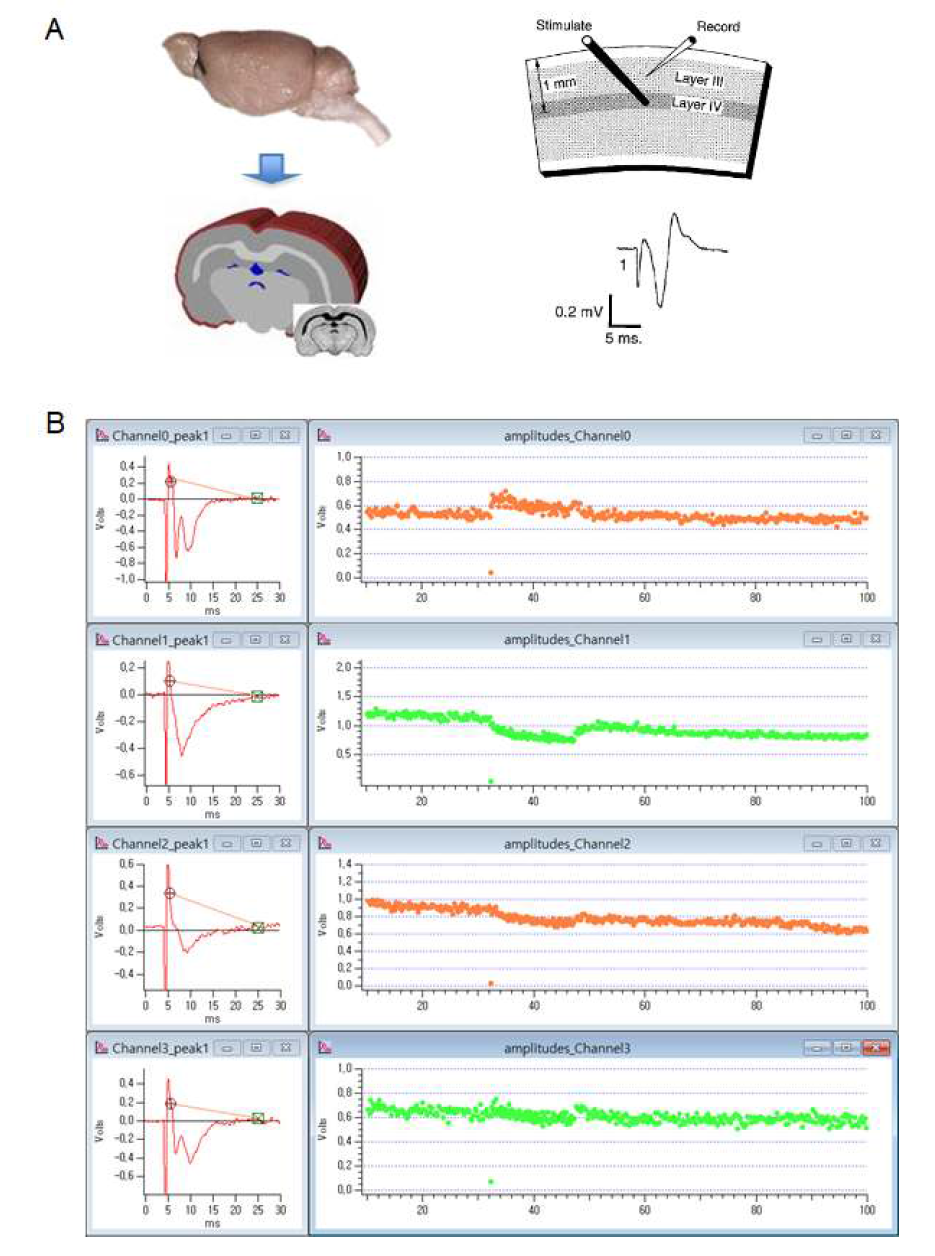 대뇌시각피질과 대뇌측두피질 뇌절편 제작 및 다채널 신경반응 측정