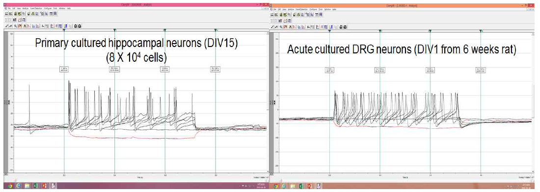 1차 배양 해마신경세포와 체성감각 DRG neuron의 excitability 비교