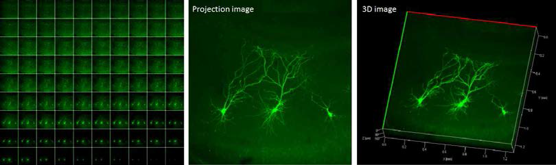 해마체 조직절편내 신경망의 형태적 분석을 위한 선별적 세포 표지법