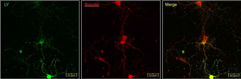 배양된 해마 신경세포를 이용한 신경망의 형태적 분석을 위한 선별적 세포 표지법.