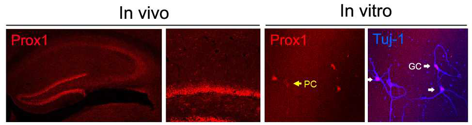 치상세포의 핵에 선택적으로 발현하는 전사인자인 Prox1을 선택적으로 염색한 사진.