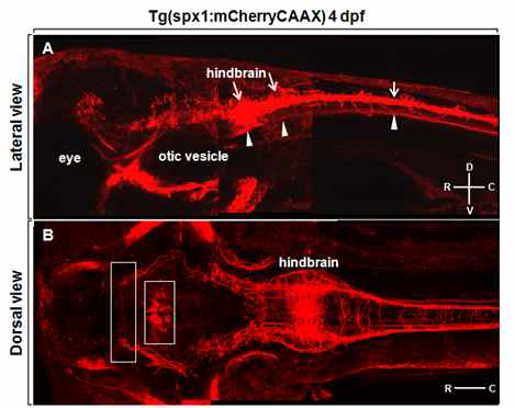 SPX1 신경펩타이드 특이적 형광 단백질을 발현하는 형질전환 제브라피쉬의 in vivo imaing