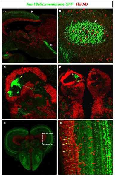 성체 fam19a5c:membrane GFP transgenic 제브라피쉬를 이용한 fam19a5c의 신경망 분석