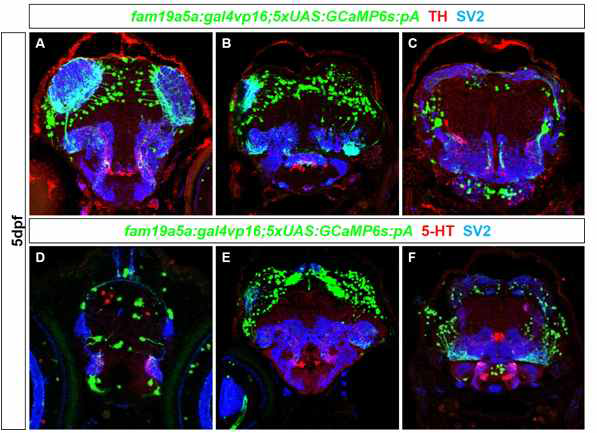 fam19a5a 특이적 제브라피쉬에서 TH와 5-HT 에 대한 면역조직염색.