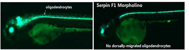 serpinf1 유전자의 loss-of-function phenotype