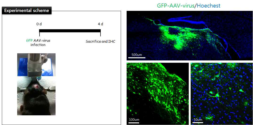 AAV 감염을 통한 고삐핵의 GFP 발현 관찰