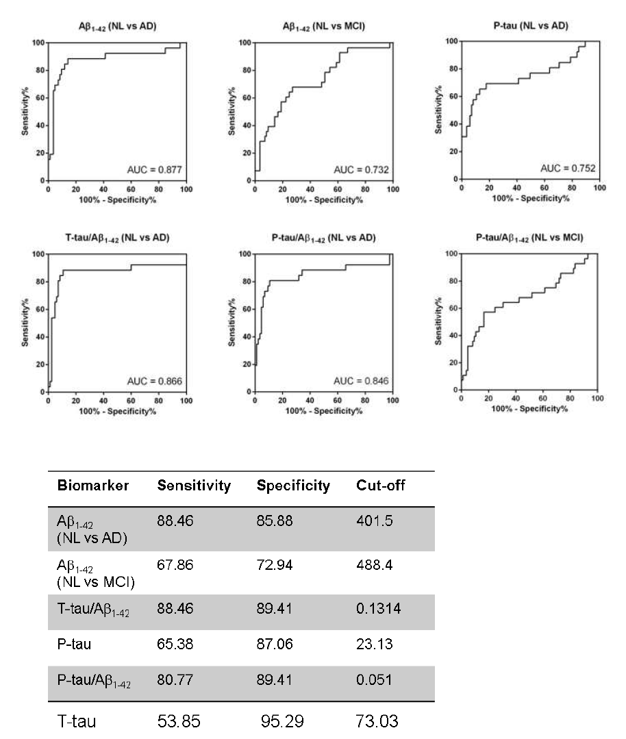 알츠하이머치매 진단의 ROC curve와 민감도와 특이도