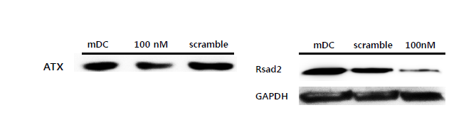후보 유전자 Rsad2, Enpp2의 western blot을 통한 gene silencing 확인시험