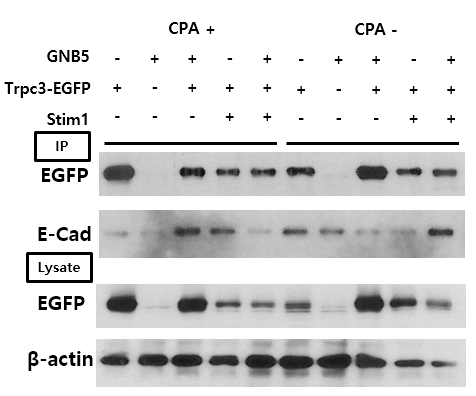 TRPC3의 세포막 발현과 GNB5 HEK293T세포주에 각각의 subunit을 발현 시킨 후, CPA에 의하여 저장고-의존성 칼 슘유입을 활성화시켰음. 이후에 공초점 현 미경을 통하여 관찰한 결과를 특별한 차이 를 찾을 수 없었음. 또한 Biotinylation을 통하여 확인한 결과 세포막의 Trpc3의 localization 또한, GNB5의 발현에 따라 유 의미하게 변화하는 것을 확인할 수 없었음