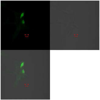 HEK293 세포주에서 GNB1의 발 현 양상 GFP 영상(좌측상단)과 DIC 영상(우측 상단), 그리고 통합영상 (좌측하단)을 나타냄. DIC 영상에서 보이는 세포들 중 일부에 GFP가 발현되고 있음을 확인할 수 있음. 또한, GFP가 발현되고 있는 세 포를 살펴보면 핵과 주위의 세포질 전체 에 GFP 신호가 분포되어 있는 것을 관 찰할 수 있음