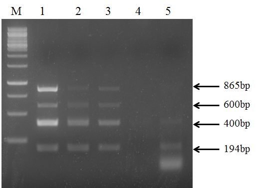 dNTP 존재 하에서 erythropoietin gene (타깃 194 bp), hemoglobin gene (타깃 400 bp), β -actin gene (타깃 600 bp), β-globin gene (타깃 865 bp) 들을 PCR 방법으로 증폭시킬 8 종류의 프라 이머들을 반응용액에 함께 넣고 Neq HS M3 DNA 중합효소 (lane 1), HS Taq DNA 중합효소 (Roche) (lane 2), HS Taq DNA 중합효소 (Takara) (lane 3), Taq DNA 중합효소 (Takara) (lane 4) 및 Pfu DNA 중합효소 (Promega) (lane 5)를 이용한 multiplex PCR을 수행한 결과를 나타낸 것이다