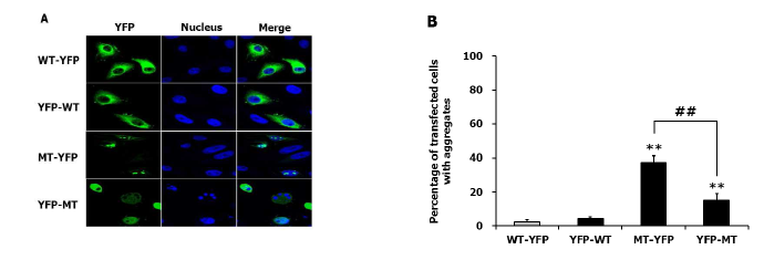 YFP 도입에 따른 돌연변이 헌팅틴 단백질의 응집형성 빈도 차이 관찰