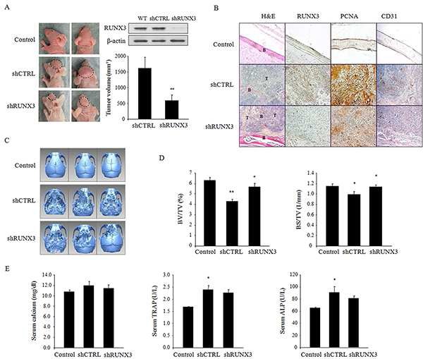 암세포의 뼈 침습 생쥐 모델에서 RUNX3 발현 및 발현 억제 구강암 세포에 의한 뼈 손상을 조사함. A. 종양 부피, B. 종양 성장 마커, C. 뼈 손 상 이미지, D. 뼈 형태학 지표, E. 뼈 손상의 혈청내 생화학적 지표