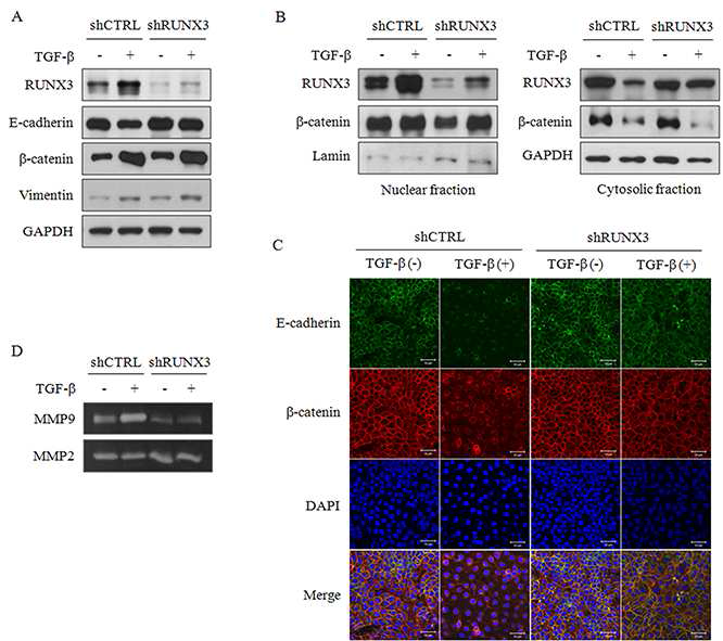 RUNX3 발현 및 발현 세포에서 EMT 관련 단백질의 발현 및 활성을 조사함. A-C. 단백질 발현 및 핵내 이동, D. MMP 활성