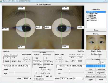 자동화된 Standalone 사시각 측정 프로그램