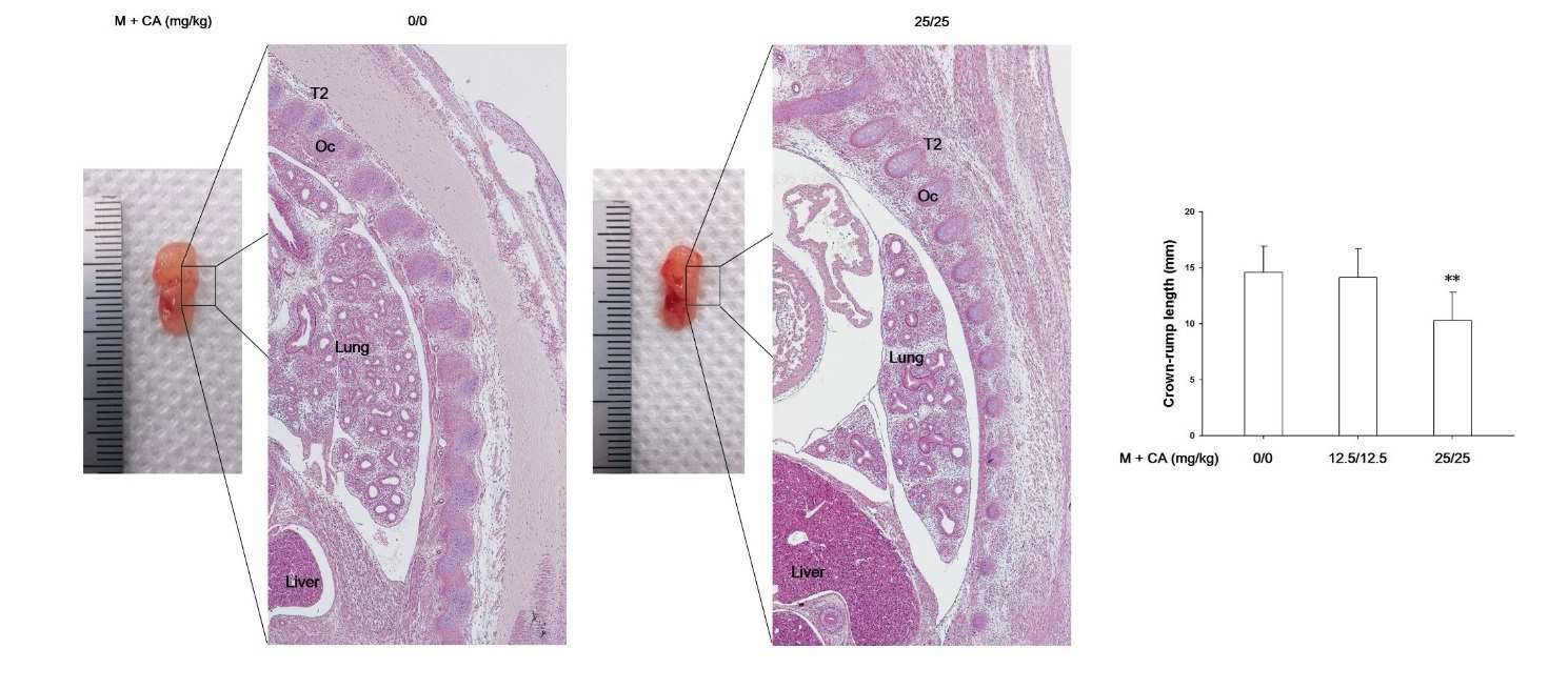 Morphology and histology in fetus treated with melamine and cyanuric acid. Representative images of fetus and thoracic vertebrae from vehicle control and melamine and cyanuric acid group at dose level of 25/25 mg/kg/days. The bar graphs present length of crown-rump of vehicle control and melamine and cyanuric acid treated groups at dose levels of 12.5/12.5 or 25/25 mg/kg/days. Values are presented as mean±SD