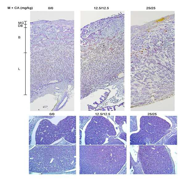 TUNEL analysis in placenta and fetal liver treated with melamine and cyanuric acid in pregnant rats. Representative images of placenta and fetus from vehicle control and melamine and cyanuric acid treated groups at dose levels of 12.5/12.5 or 25/25 mg/kg/days. Brown-colored cells indicate TUNEL-positive cells. The slides were counter stained with Harris hematoxylin (􌝦50). The placenta and fetal liver from vehicle group shows a few of TUNEL-positive cells. Melamine and cyanuric acid-treated groups show increased TUNEL-positive cells in labyrinth zone and basal zone of placenta and fetus liver. The placenta and fetal liver from melamine and cyanuric acid 25/25 mg/kg treated group shows extensive disrupted trophoblastic septa with in creased TUNEL-positivity. Notes. L, labyrinth zone; B, basal zone; DB, decidua basalis; MG, metrial glands