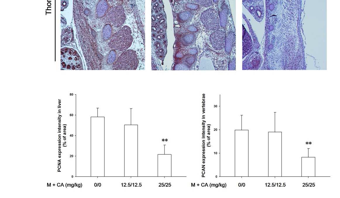 PCNA expression in fetal liver and thoracic vertebrae of rats treated with melamine and cyanuric acid. Brown-colored cells indicate PCNA -positive cells. The slides were counterstained with Harris hematoxylin (×50). The bar graphs showed the immunopositivity of PCNA in the fetus from vehicle group and melamine and cyanuric acid treated groups. The liver and thoracic vertebrae from vehicle and melamine and cyanuric acid 12.5/12.5 mg/kg-treated rats showed plenty of PCNA-positive cells in liver and around the ossification center. Fetus treated with melamine and cyanuricacid 25/25 mg/kg shows decreased immunopositivity of PCNA in the liver and around the ossification center