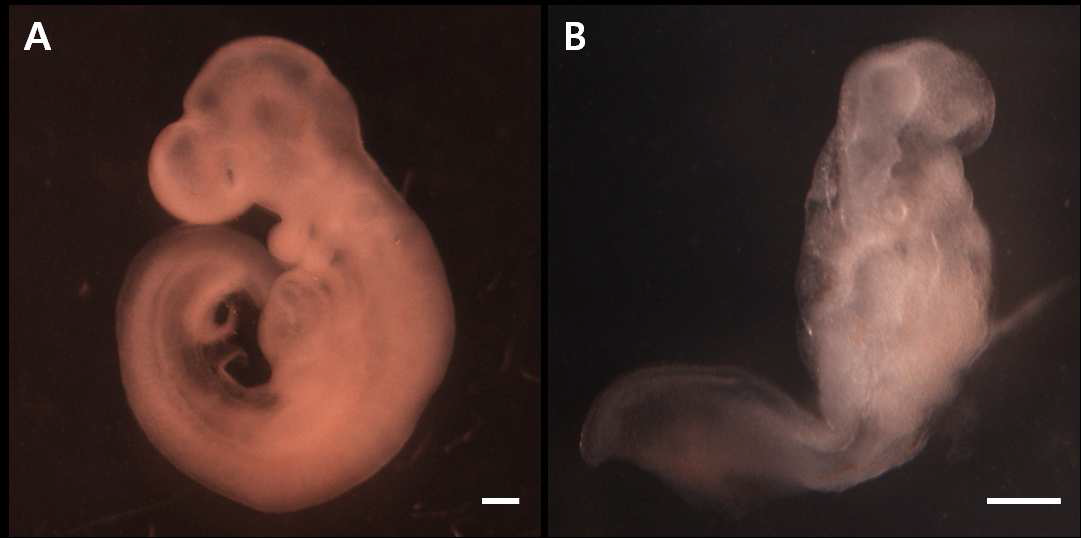 (A) Normal embryo development after 48 h of culture in control serum from gestational day 9.5. (B) Embryo with severe morphological abnormalities after 48 h of exposure to 15 μg/ml of silver nanoparticles. Bar = 0.25 mm