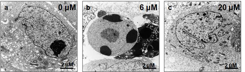 Morphological analysis of LNCaP cells treated with MCS-C3 by Transmission electron microscopy