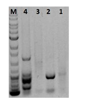 자연시료로부터 phaZ유전자 다양성을 확인하기 위한 PCR-DGGE 분석 river (lane 1), soils (lane 2 & 3), and sludge (lane 4) samples
