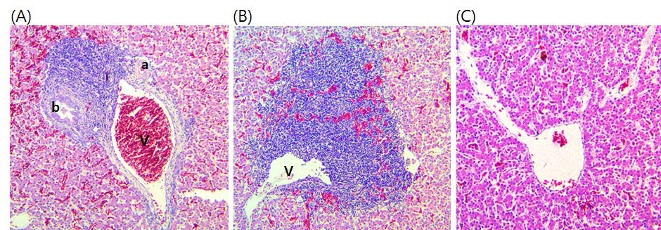 Periphlebitis observed in the portal triads of the livers from a chicken inoculated with RNA transcripts from the original Korean avian HEV cDNA clone. Note the infiltrated inflammatory cells including lymphocytes and histiocytes around the portal triad. (A). Severe periphlebitis observed around the central vein of the livers from a chicken inoculated with RNA transcripts from the chimeric infectious cDNA clone (pTK-GI-B-HVR) (B). Liver of the non-infected normal chicken. Histologically, the liver shows normal structures (C). H&E stain, X100.