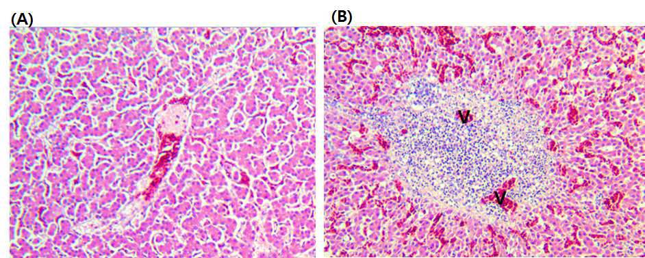 Liver of the non-infected normal chicken. Histologically, the liver shows normal structures (A). Periphlebitis observed in the portal triads of the livers from a chicken inoculated with RNA transcripts from the avian HEV cDNA clone (pT4-aHEV-K2). Note the infiltrated inflammatory cells, mainly lymphocytes, around the portal veins (v) (B). H&E stain, X100.